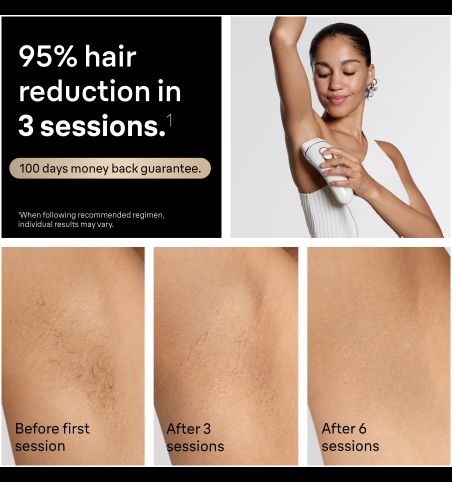 Braun Silk-expert Pro PL5210 IPL Intense pulsed light (IPL) Gold, White