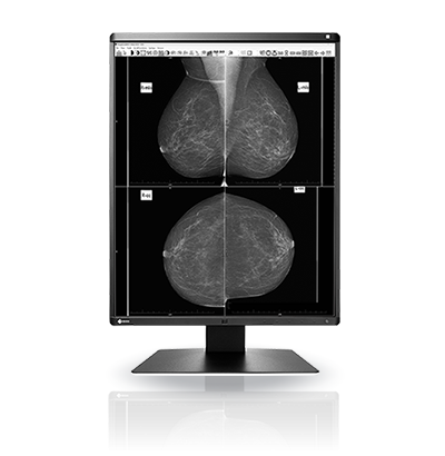 Medical monitor EIZO RadiForce GX560 5MP Monochrome