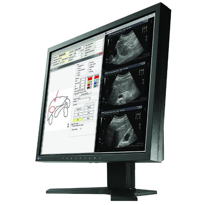 Medical monitor EIZO RadiForce MX194 1MP Color