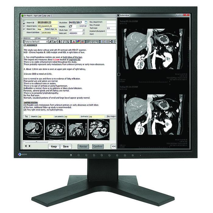 Medical monitor EIZO RadiForce MX194 1MP Color