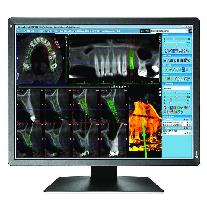 Medical monitor EIZO RadiForce MX216-HB 2MP Color