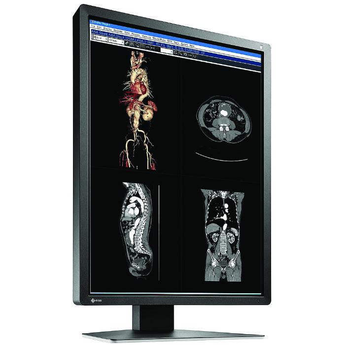 Medical monitor EIZO RadiForce MX216-HB 2MP Color