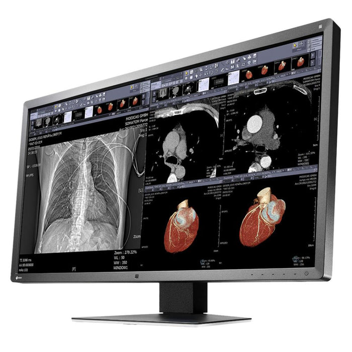 Medical monitor EIZO RadiForce MX315W 8MP Color