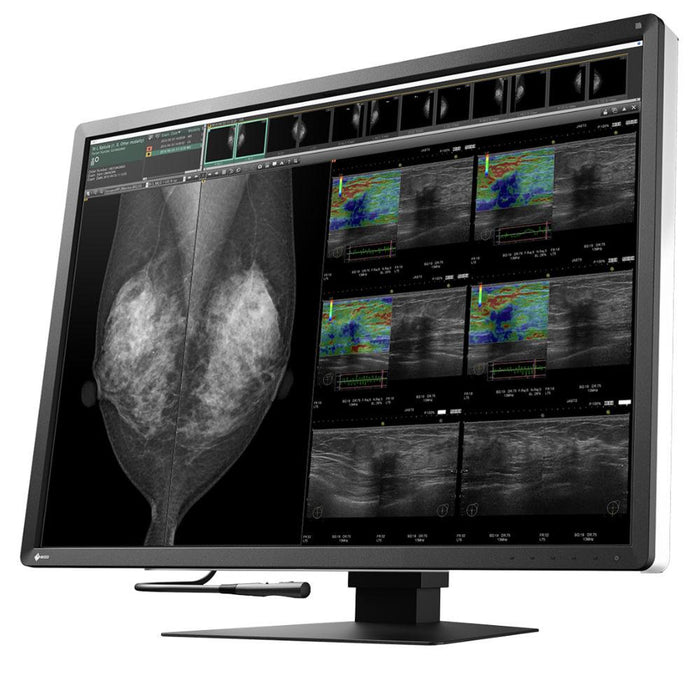 Medical monitor EIZO RadiForce RX1270 12MP Color