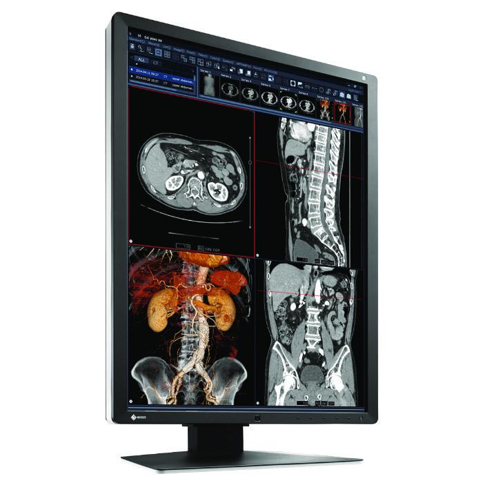 Medical monitor EIZO RadiForce RX250 2MP Color
