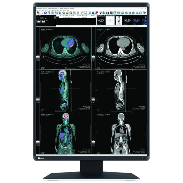 Medical monitor EIZO RadiForce RX370 3MP Color