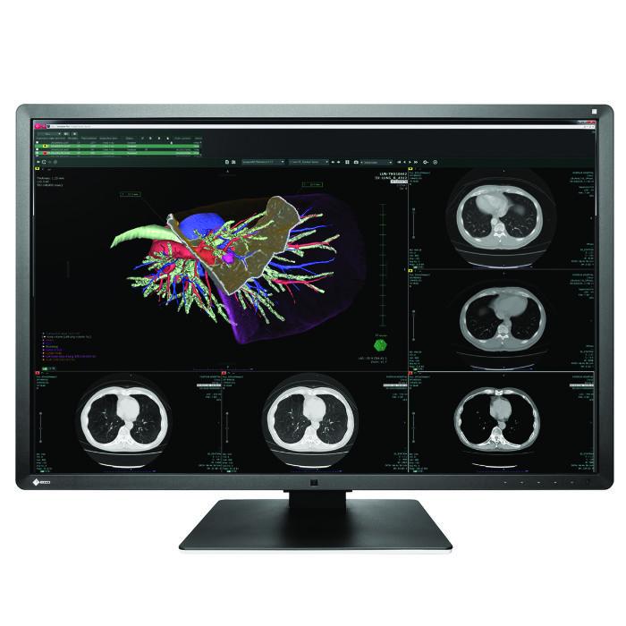 Medical monitor EIZO RadiForce RX660 6MP Color